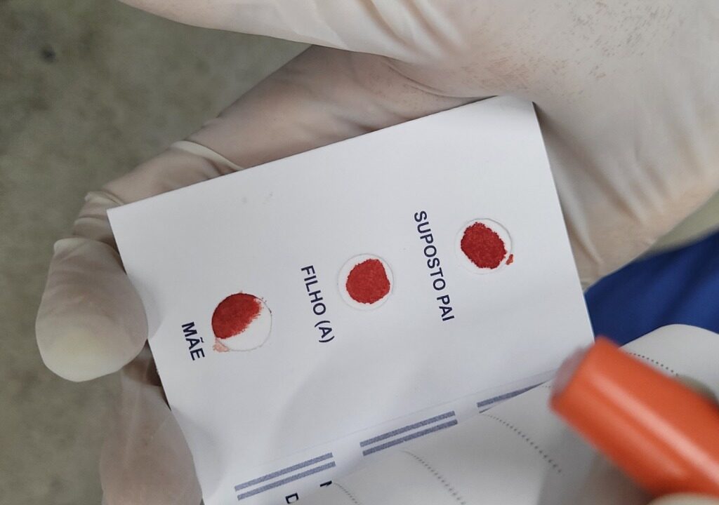 Imagem mostram material biológico recolhido durante teste de paternidade.